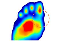 XSENSOR System pomiaru dystrybucji ciśnienia