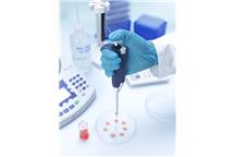 Jak dobrać odpowiednią pipetę do zastosowania laboratoryjnego?